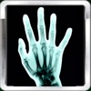 Рентгеновское сканирование +(X-Ray Scan +)