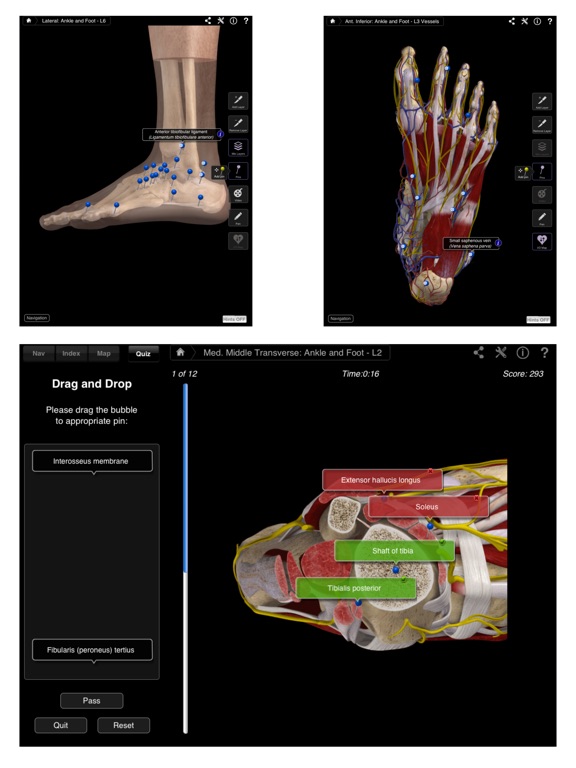 Ankle and Foot Pro III Screenshots