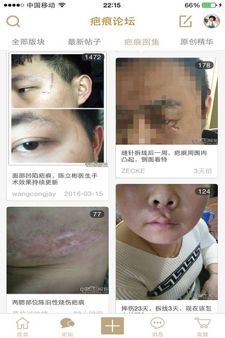 中国疤痕论坛 screenshot