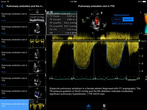 iPad Screenshot 4
